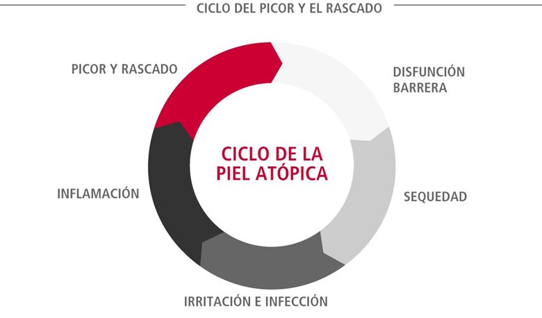 El ciclo de la piel atópica (también conocido como el ciclo del picor y el rascado)